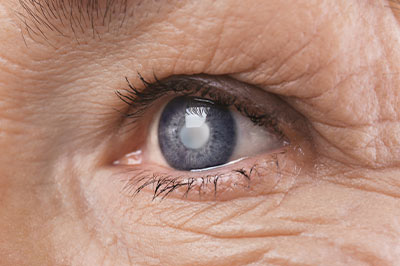 Vision City   of Arlington | Adult   Senior Eye Exams, Diabetic Eye Exams and Children   s Eye Examinations